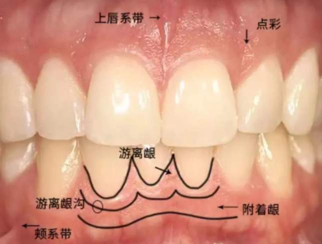 牙缝里那块肉悄悄没了，为啥再也长不回来？可能和你每天做的事有关