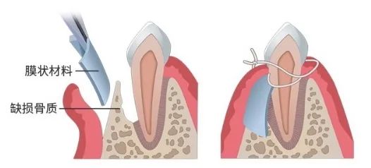 牙缝里那块肉悄悄没了，为啥再也长不回来？可能和你每天做的事有关