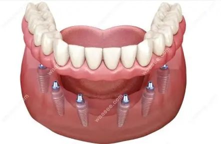 牙缝里那块肉悄悄没了，为啥再也长不回来？可能和你每天做的事有关